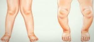 We did not find results for: Gangguan Dan Kelainan Sistem Gerak Manusia Beserta Penyebabnya