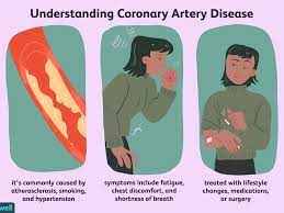 How Coronary Artery Disease Is Treated