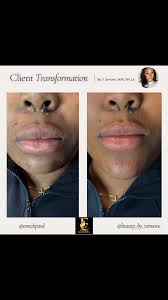 Ve Simone, MSN, RN, LE (@brow_estheticsd) · Instagram 照片和视频