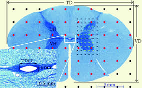 The most common causes of infarction are vertebral. Gross Section Of The Spinal Cord Scanned Image Central Canal Download Scientific Diagram