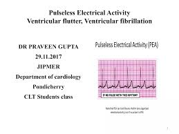 Image result for Pulseless Electrical Activity