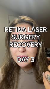 Recovery Precision Tx Laser