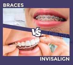 Your dentist will need accurate image of your teeth to proceed. Metal Braces Vs Invisalign Bali Implant Aesthetic Bia Dental Center