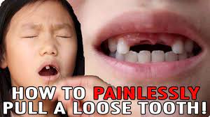 This could be caused from trauma. How To Pull A Loose Tooth No Cry Teeth Pulling Method Easily Extract Baby Teeth Youtube