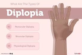 Image result for Diplopia