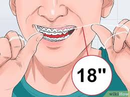 Use any kind of toothpaste, and brush flat against the braces, and down over the brackets, so you're pushing any food or debris out from under the wire. How To Clean Teeth With Braces 12 Steps With Pictures Wikihow