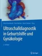 Als die adnexe (deutsch das anhangsgebilde, lateinischer plural adnexa oder deutsch adnexen) bezeichnet man in der medizinischen fachsprache meist den eierstock (lateinisch das ovar. Ultraschall In Der Gynakologie Adnexe Springermedizin De