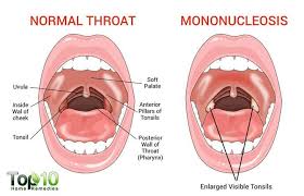 Maybe you would like to learn more about one of these? Pin On Mono