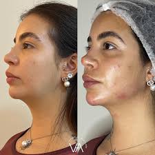 Vanessa Fortes Estética Avançada