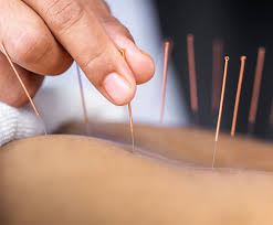 ** just letting you know that in addition to our usual september weekend cohort, we are taking applications for an october weekday group (usually thursday/friday attendance). Cnm Diploma Courses In Nutrition Herbal Medicine Acupuncture And Natural Chef