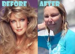 Heather Locklear Plastic Surgery Bad Celebrity Plastic Surgery Plastic Surgery Gone Wrong Plastic Surgery