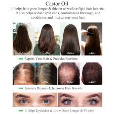 The classic oil is thought to be the golden elixir of hair growth, but most professionals and the research says, ehh, not really. Essential Castor Oil Fast Hair Growth For Eyelashs Eyebrows Shopee Philippines