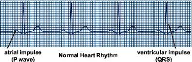 Women Abnormal Heart Beats Cleveland Clinic