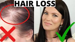 The lawsuit and controversy have actually been going on for a few years now, and there have actually been multiple lawsuits pending over the last couple years. Hair Falling Out Thinning Hair Grow Your Hair Fast Hair Loss Wen Youtube