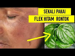 Flek Hitam Rontok Dalam Sekali Pemakaian Dengan Cara Ini Youtube