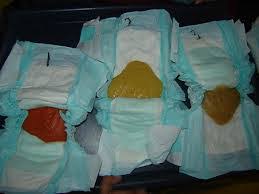 Najis bayi warna hijau minum susu formula. Tahi Bayi Kuning Detiklife