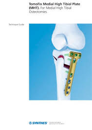 Tomofix Depuy Synthes Pdf Catalogs Technical Documentation