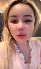 Dàn hot girl gần như "thay mặt” vì dao kéo: Bạn thân Huyền Baby suýt hoại  tử cằm, Ngân 98 mặt biến dạng