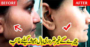 Another quick way is to use an excellent scrub to remove the facial hair and retard the growth of the unwanted hair on the face. Remove Unwanted Hair From Face At Home Tips In Urdu Hindi