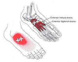 Pin On Human Anatomy