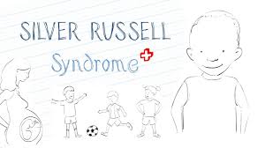 What Is Silver Russell Syndrome Srs