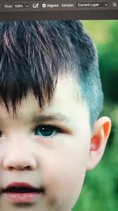 When your kid gets a shiner...