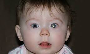 Bladder cancer signs and symptoms may include: Charity Urges Action To Speed Up Detection Of Eye Cancer In Children Spectrum
