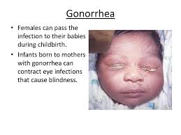 Maybe you would like to learn more about one of these? Sexually Transmitted Diseases Ppt Download