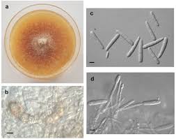 Image result for Dacryotrichia