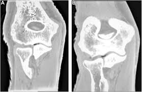 Image result for Traumatic Arthrotomy