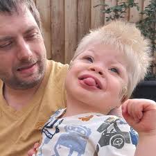 Dad's message of hope over son's rare condition that's left him unable to  crawl