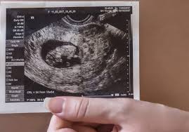 Ia sangat bergantung kepada bilakah anda. Bolehkah Upt Positif Tapi Sebenarnya Tidak Hamil Jangan Gembira Dulu Sebelum Ia Disahkan Pa Ma