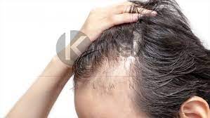 Embrace your natural hair color by simply adding highlights, or go halfway by getting an ombre or balayage. Color Hair Sprays The Fastes Solution For Thinning Hair And Grey Hair Your Instant Hair Makeup Hair Fiber Kmax