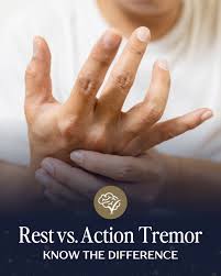 Image result for Rest Tremor