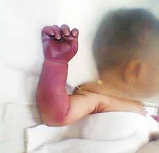 Https Www Indianpediatrics Net Sep2014 763 764 Pdf