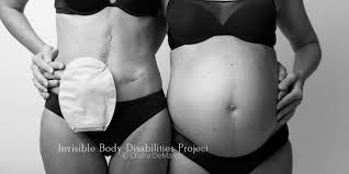 Aiutare e condividere l'esperienza di questa malattia. Invisible Body Disabilities La Bellezza Delle Guerriere Che Non Si Nascondono Roba Da Donne