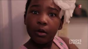 A Flint (USA), des enfants perdent leurs cheveux...