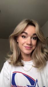 Removing my Scleral Shell Eye Prosthetic for the First Time