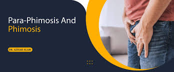 Image result for Phimosis