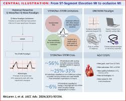 Image result for ST Segment