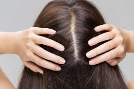 Pin On Scalp