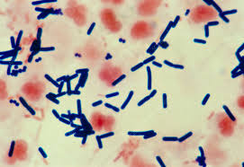 Image result for Clostridium