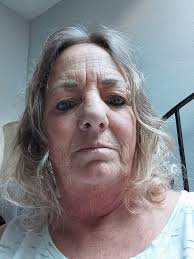 What to do with thinning and graying hair?