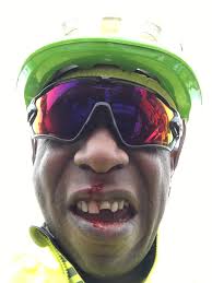 FCITT... Taken out by a motorist joining the road from the left during warm  up. Broken tooth, bruises, completely broken carbon bike. At Ruiru Police  station reporting... Race #25 Eye witnesses may