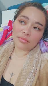 UPDATE del día 4 de mi #tummytuck 360 con lipo en brazos y espalda con  transferencia a glúteos y espalda