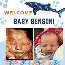 Wonder Baby 3D/4D Ultrasound