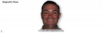 Essential Photographs To Achieve Predictable Outcomes