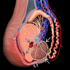 Testis testicle, usually regarded as a special application of testis. Testis Injury An Overview Sciencedirect Topics