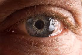 Slang terms with the same meaning. Conjunctivochalasis Eye Care In Sunnyside Ny