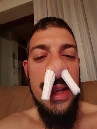 MEGA X3 spare tire mount